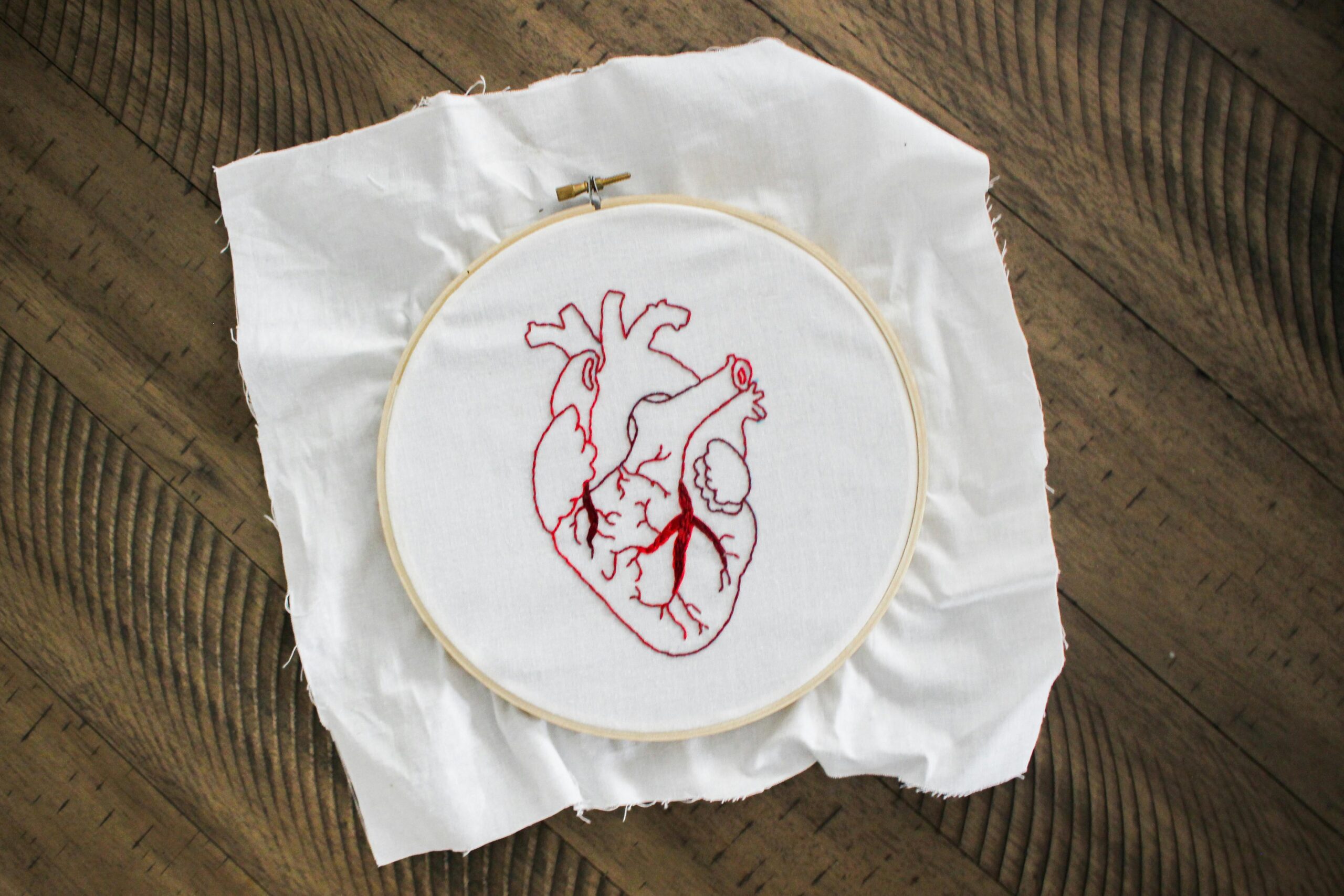 Heart Disease: Lipids vs. Inflammation — The Two Competing Hypotheses